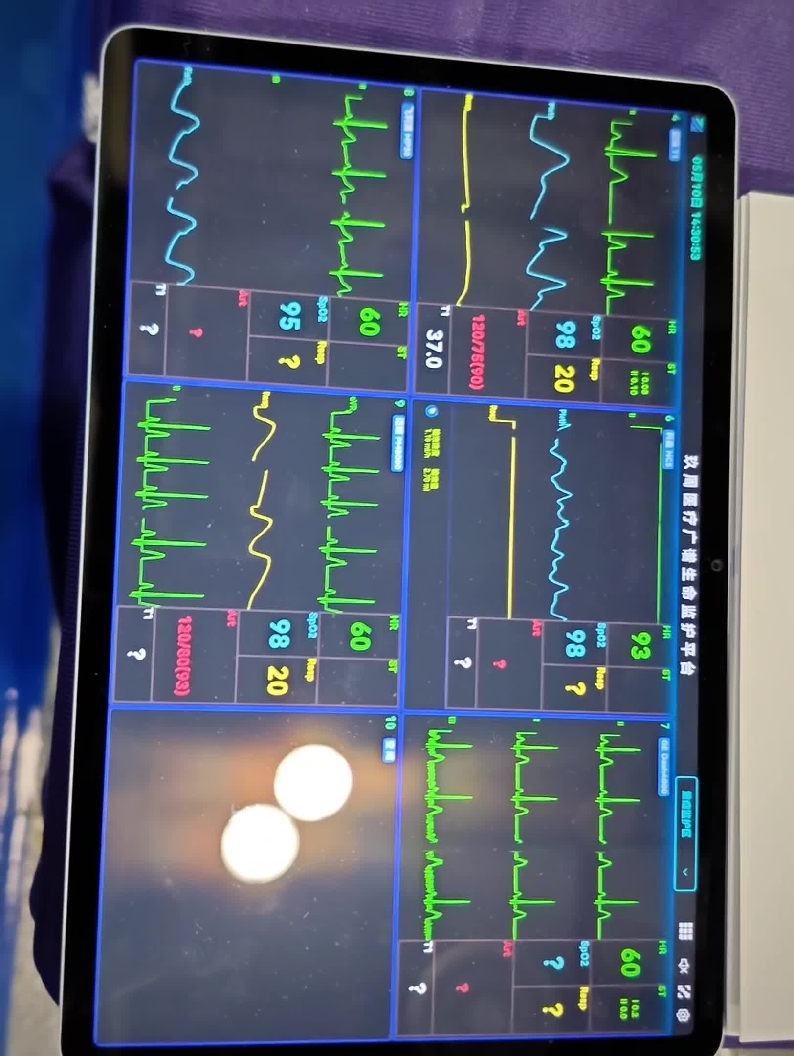 VID_20250510_143053.mov